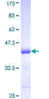 EPB41L1 / 4.1N Protein - 12.5% SDS-PAGE Stained with Coomassie Blue.