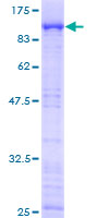 EPB41L2 Protein - 12.5% SDS-PAGE of human EPB41L2 stained with Coomassie Blue