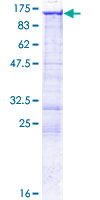 EPB41L3 Protein - 12.5% SDS-PAGE of human EPB41L3 stained with Coomassie Blue