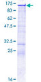 EPB41L3 Protein - 12.5% SDS-PAGE of human EPB41L3 stained with Coomassie Blue