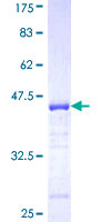 EPB41L3 Protein - 12.5% SDS-PAGE Stained with Coomassie Blue.