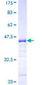 EPB41L3 Protein - 12.5% SDS-PAGE Stained with Coomassie Blue.