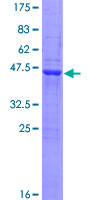EPB41L4A Protein - 12.5% SDS-PAGE of human EPB41L4A stained with Coomassie Blue