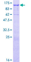 EPB41L5 Protein - 12.5% SDS-PAGE of human EPB41L5 stained with Coomassie Blue