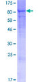 EPB42 Protein - 12.5% SDS-PAGE of human EPB42 stained with Coomassie Blue