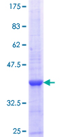EPB42 Protein - 12.5% SDS-PAGE Stained with Coomassie Blue.
