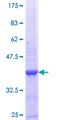 EPB42 Protein - 12.5% SDS-PAGE Stained with Coomassie Blue.