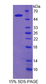 EPB42 Protein - Recombinant Erythrocyte Membrane Protein Band 4.2 By SDS-PAGE