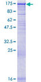 EPC1 Protein - 12.5% SDS-PAGE of human EPC1 stained with Coomassie Blue