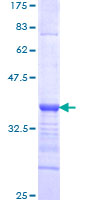 EPC1 Protein - 12.5% SDS-PAGE Stained with Coomassie Blue.