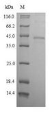 EPCAM Protein - (Tris-Glycine gel) Discontinuous SDS-PAGE (reduced) with 5% enrichment gel and 15% separation gel.