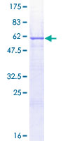 EPCAM Protein - 12.5% SDS-PAGE of human EPCAM stained with Coomassie Blue