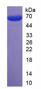EPCAM Protein - Recombinant Epithelial Cell Adhesion Molecule (EPCAM) by SDS-PAGE
