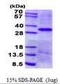 EPCAM Protein