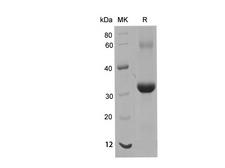 EPCAM Protein - Recombinant Human EpCAM Protein (His Tag)-Elabscience