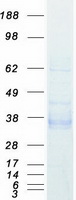 EPCAM Protein - Purified recombinant protein EPCAM was analyzed by SDS-PAGE gel and Coomassie Blue Staining