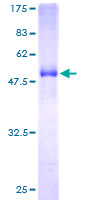 EPDR / EPDR1 Protein - 12.5% SDS-PAGE of human EPDR1 stained with Coomassie Blue