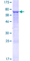 EPG5 / KIAA1632 Protein - 12.5% SDS-PAGE of human EPG5 stained with Coomassie Blue
