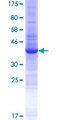 EPGN / Epigen Protein - 12.5% SDS-PAGE of human EPGN stained with Coomassie Blue