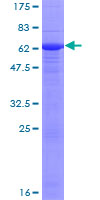EPHA10 / EPH Receptor A10 Protein - 12.5% SDS-PAGE of human EPHA10 stained with Coomassie Blue