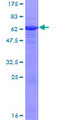 EPHA10 / EPH Receptor A10 Protein - 12.5% SDS-PAGE of human EPHA10 stained with Coomassie Blue