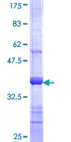 EPHA10 / EPH Receptor A10 Protein - 12.5% SDS-PAGE Stained with Coomassie Blue.