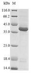 EPHA2 / EPH Receptor A2 Protein - (Tris-Glycine gel) Discontinuous SDS-PAGE (reduced) with 5% enrichment gel and 15% separation gel.