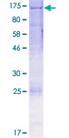 EPHA2 / EPH Receptor A2 Protein - 12.5% SDS-PAGE of human EPHA2 stained with Coomassie Blue