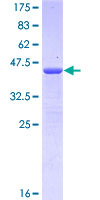 EPHA2 / EPH Receptor A2 Protein - 12.5% SDS-PAGE Stained with Coomassie Blue.