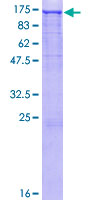 EPHA3 / EPH Receptor A3 Protein - 12.5% SDS-PAGE of human EPHA3 stained with Coomassie Blue