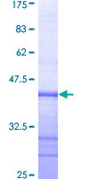 EPHA3 / EPH Receptor A3 Protein - 12.5% SDS-PAGE Stained with Coomassie Blue.