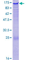 EPHA4 / EPH Receptor A4 Protein - 12.5% SDS-PAGE of human EPHA4 stained with Coomassie Blue