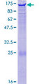 EPHA4 / EPH Receptor A4 Protein - 12.5% SDS-PAGE of human EPHA4 stained with Coomassie Blue