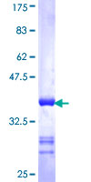 EPHA4 / EPH Receptor A4 Protein - 12.5% SDS-PAGE Stained with Coomassie Blue.