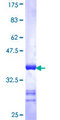 EPHA4 / EPH Receptor A4 Protein - 12.5% SDS-PAGE Stained with Coomassie Blue.