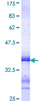EPHA5 / EPH Receptor A5 Protein - 12.5% SDS-PAGE Stained with Coomassie Blue.