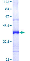 EPHA6 / EPH Receptor A6 Protein - 12.5% SDS-PAGE Stained with Coomassie Blue.