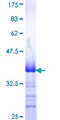 EPHA7 / EPH Receptor A7 Protein - 12.5% SDS-PAGE Stained with Coomassie Blue.