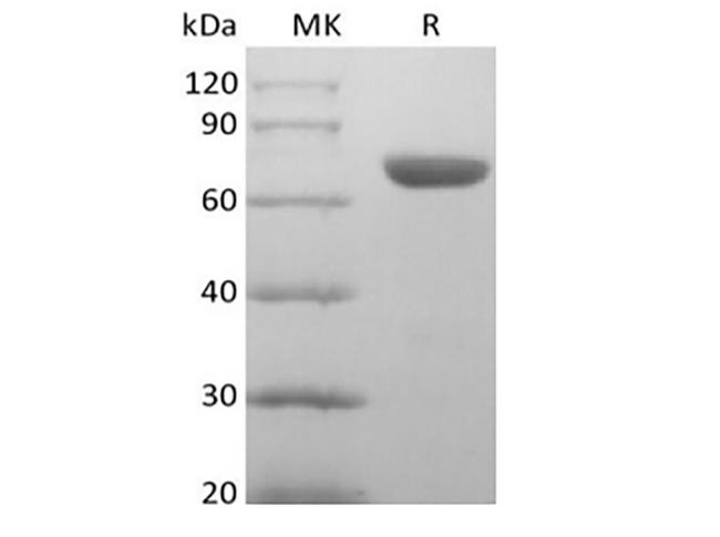 EPHA8 / EPH Receptor A8 Protein - Recombinant Human EphA8 (C-6His)