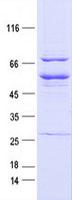EPHB1 / EPH Receptor B1 Protein