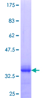 EPHB1 / EPH Receptor B1 Protein - 12.5% SDS-PAGE Stained with Coomassie Blue.