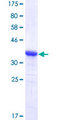 EPHB2 / EPH Receptor B2 Protein - 12.5% SDS-PAGE Stained with Coomassie Blue.