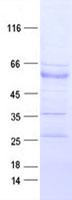 EPHB3 / EPH Receptor B3 Protein