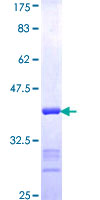 EPHB3 / EPH Receptor B3 Protein - 12.5% SDS-PAGE Stained with Coomassie Blue.
