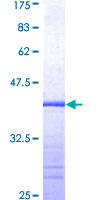 EPHB4 / EPH Receptor B4 Protein - 12.5% SDS-PAGE Stained with Coomassie Blue.