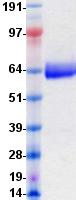 EPHB6 / EPH Receptor B6 Protein