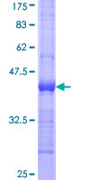 EPHB6 / EPH Receptor B6 Protein - 12.5% SDS-PAGE Stained with Coomassie Blue.