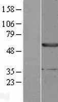 EPHX1 / Epoxide Hydrolase 1 Protein - Western validation with an anti-DDK antibody * L: Control HEK293 lysate R: Over-expression lysate