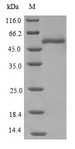 EPHX1 / Epoxide Hydrolase 1 Protein - (Tris-Glycine gel) Discontinuous SDS-PAGE (reduced) with 5% enrichment gel and 15% separation gel.