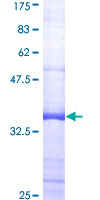 EPHX1 / Epoxide Hydrolase 1 Protein - 12.5% SDS-PAGE Stained with Coomassie Blue.